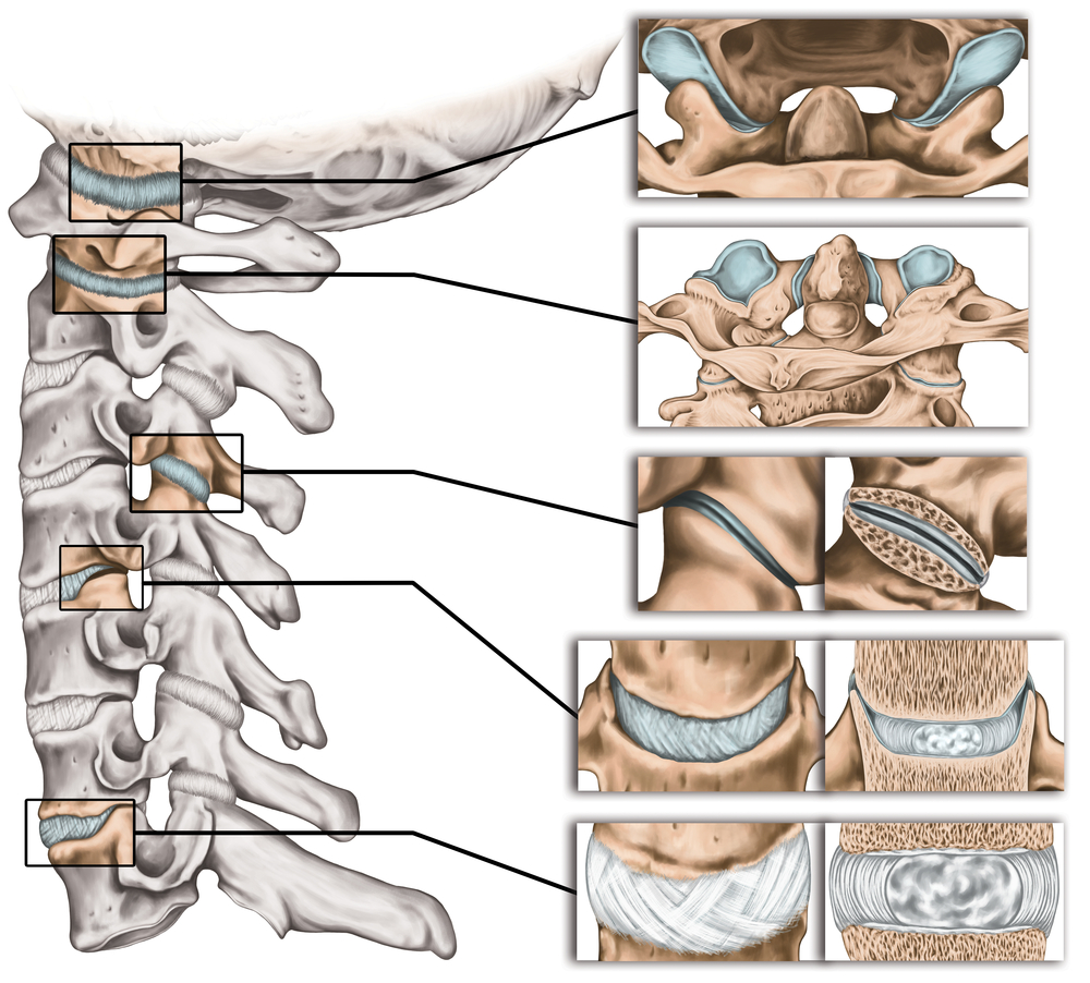 vertebral facet