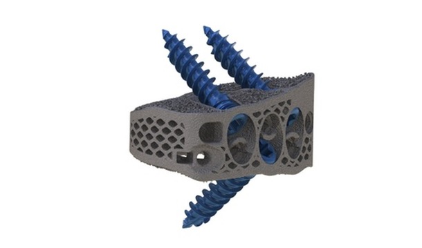 3D printed metal body cage